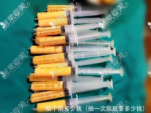 抽个脂多少钱(抽一次脂肪要多少钱)