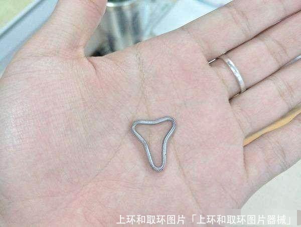 上环和取环图片「上环和取环图片器械」