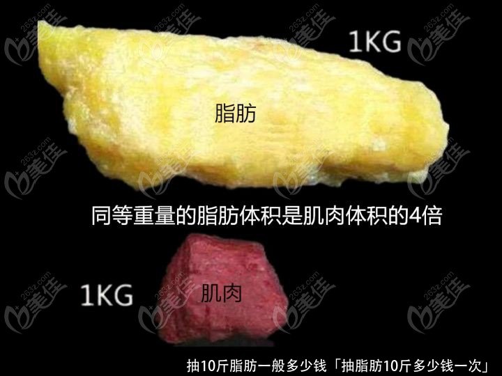 抽10斤脂肪一般多少钱「抽脂肪10斤多少钱一次」 
