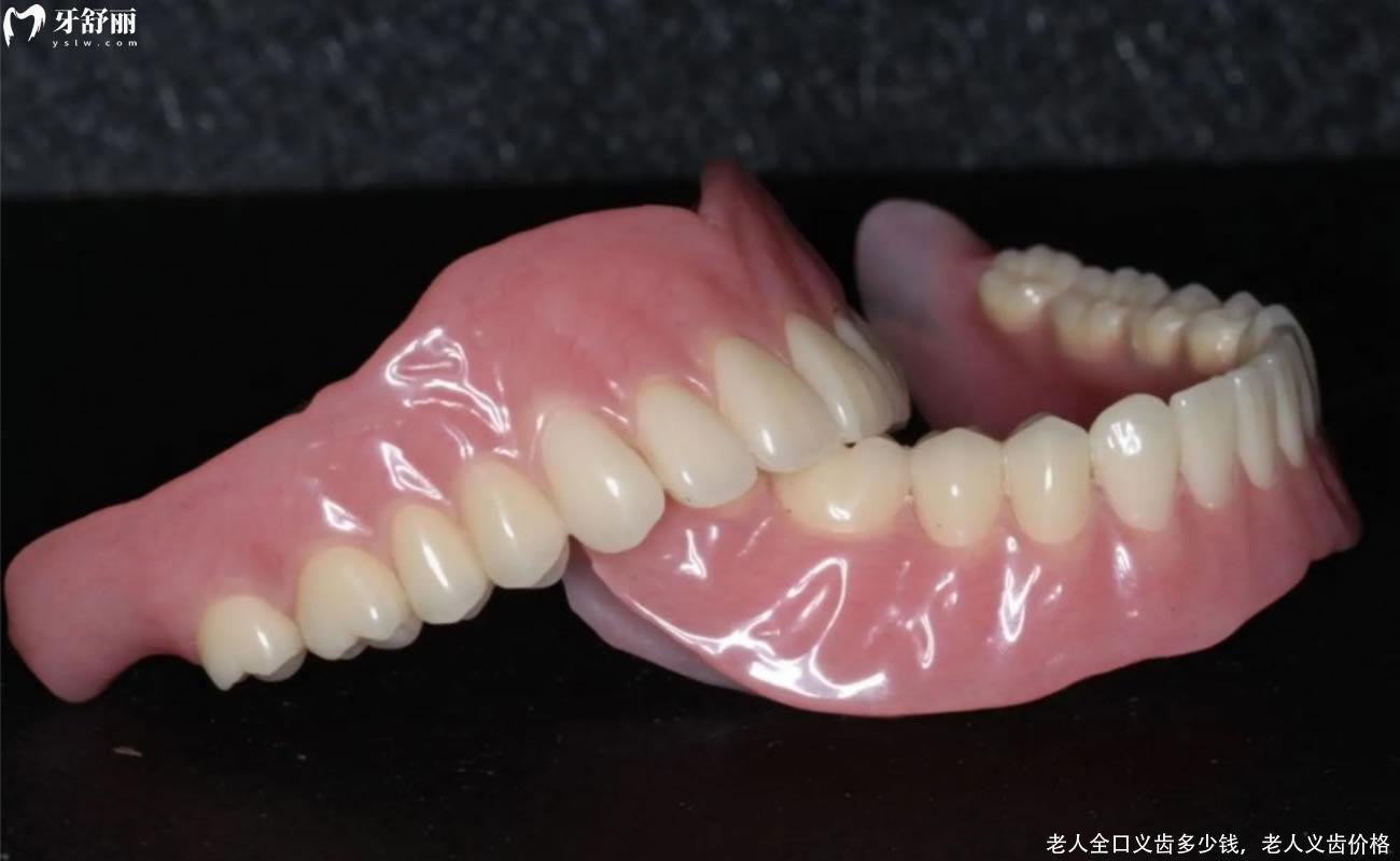 老人全口义齿多少钱,老人义齿价格