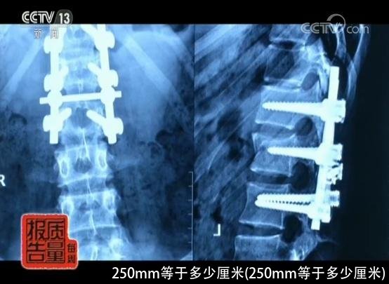 250mm等于多少厘米(250mm等于多少厘米)
