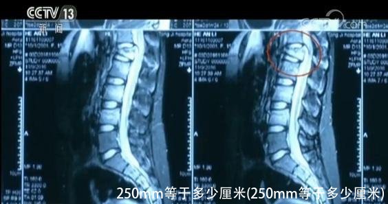 250mm等于多少厘米(250mm等于多少厘米)
