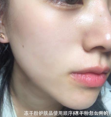 冻干粉护肤品使用顺序(冻干粉怎么用的)