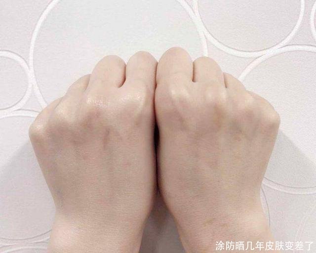 涂防晒几年皮肤变差了