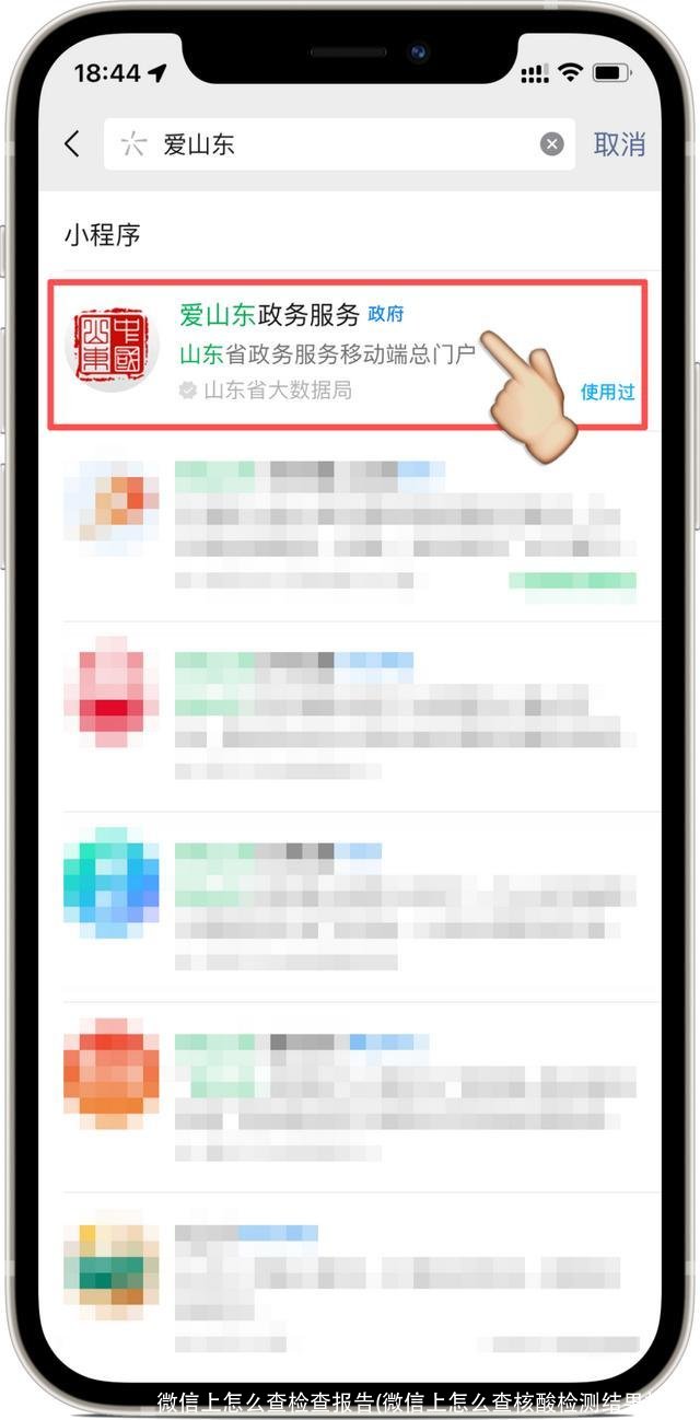 微信上怎么查检查报告(微信上怎么查核酸检测结果报告)