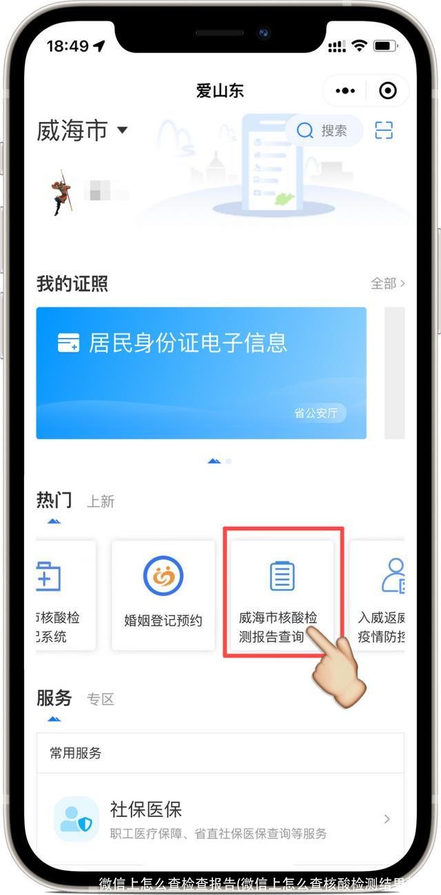 微信上怎么查检查报告(微信上怎么查核酸检测结果报告)