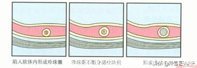 紫色珍珠为什么不值钱(浅紫色珍珠为什么不值钱)