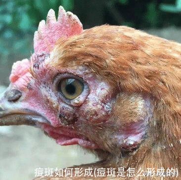 痘斑如何形成(痘斑是怎么形成的)