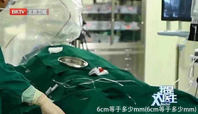 6cm等于多少mm(6cm等于多少mm)