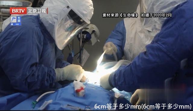 6cm等于多少mm(6cm等于多少mm)