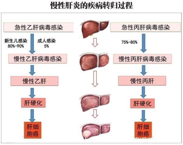 世界五大绝症(世界五大绝症(目前无法治愈))
