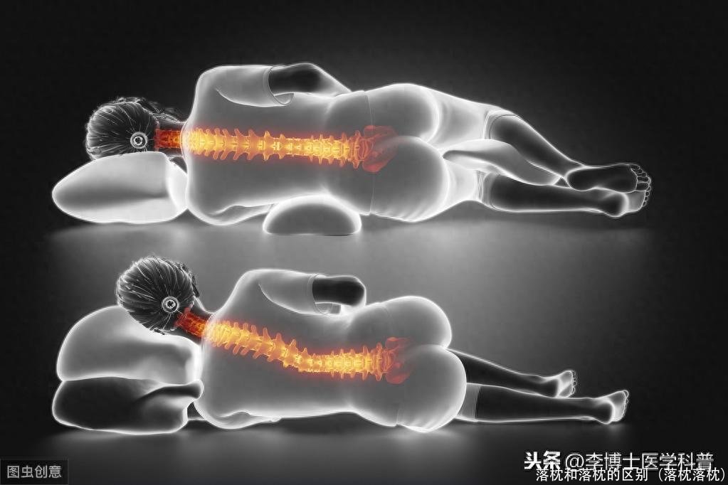 落枕和落枕的区别（落枕落枕）