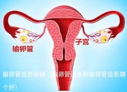 输卵管造影价格(输卵管通水和输卵管造影哪个好)